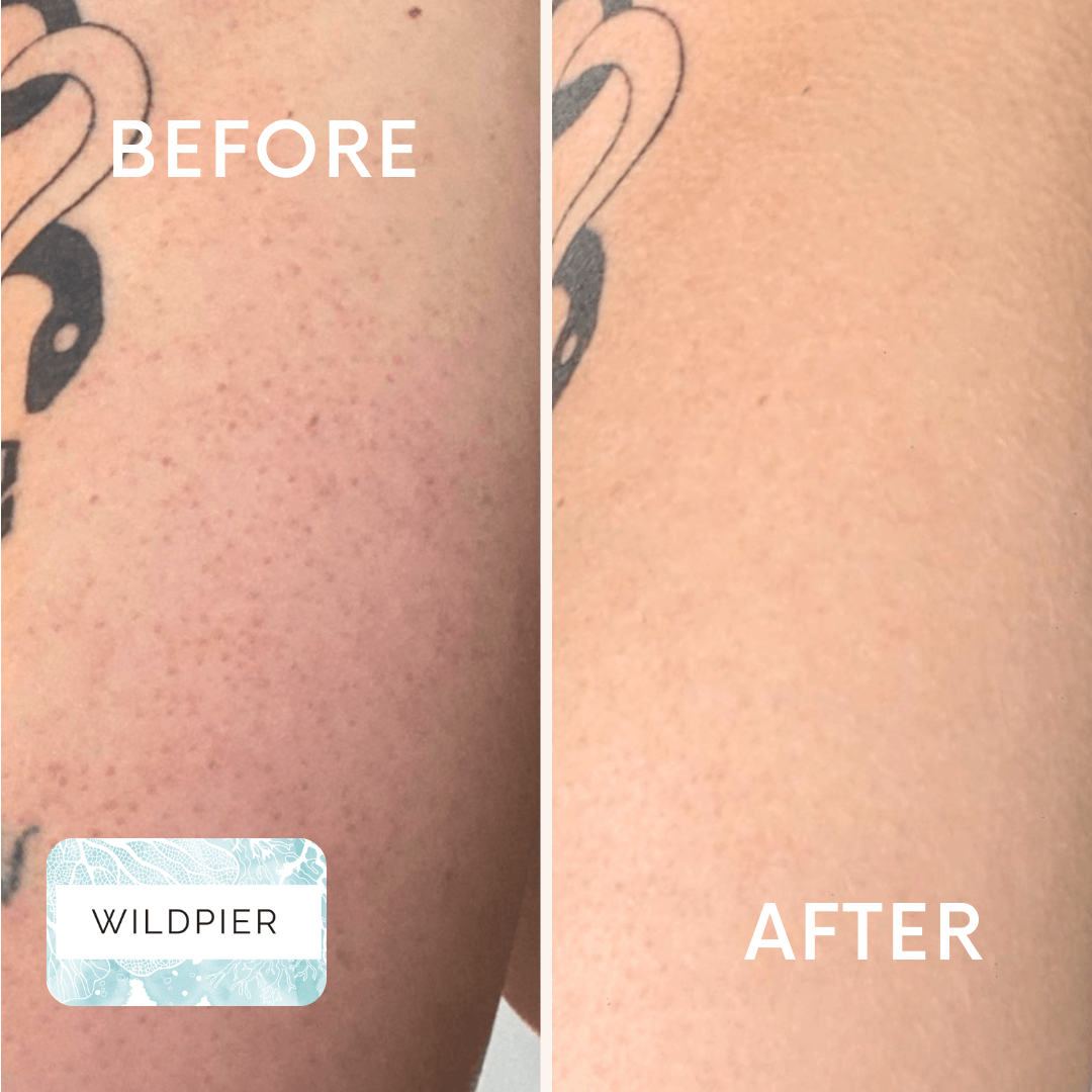 Wildpier™ Luxe Deep Exfoliating Glove