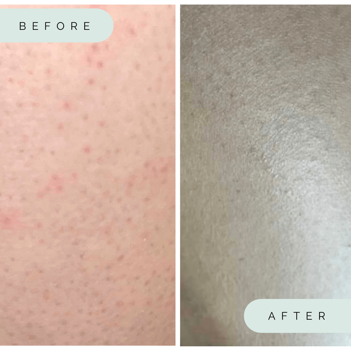 Wildpier™ Luxe Deep Exfoliating Glove and Konjac Sponge Bundle