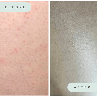 Wildpier™ Plus+ Deep Exfoliating Glove