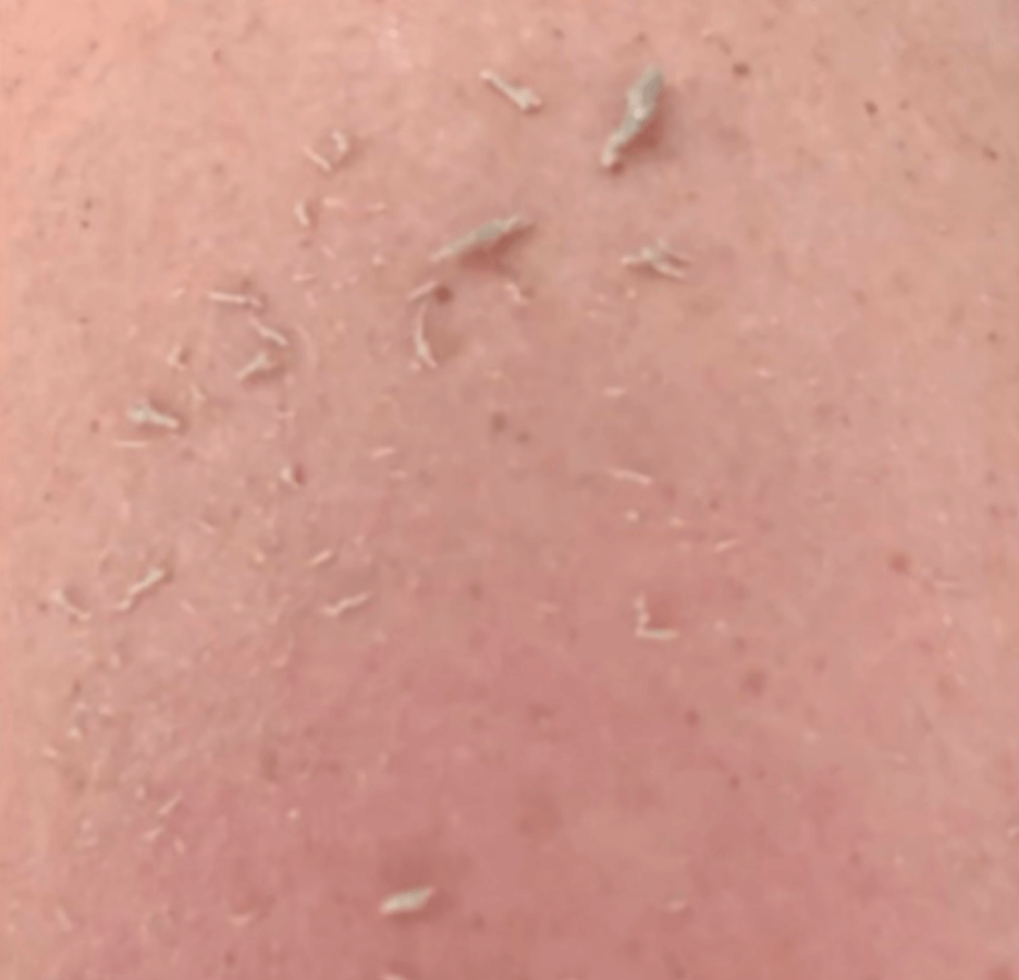 Wildpier™ Everything Bundle