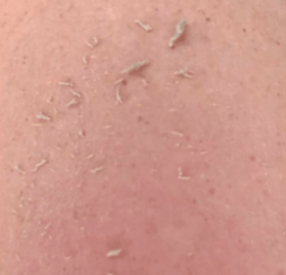 Wildpier™ Everything Bundle