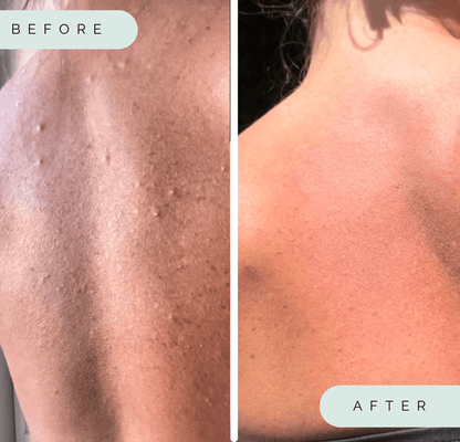 Wildpier™ Deep Exfoliating Towel