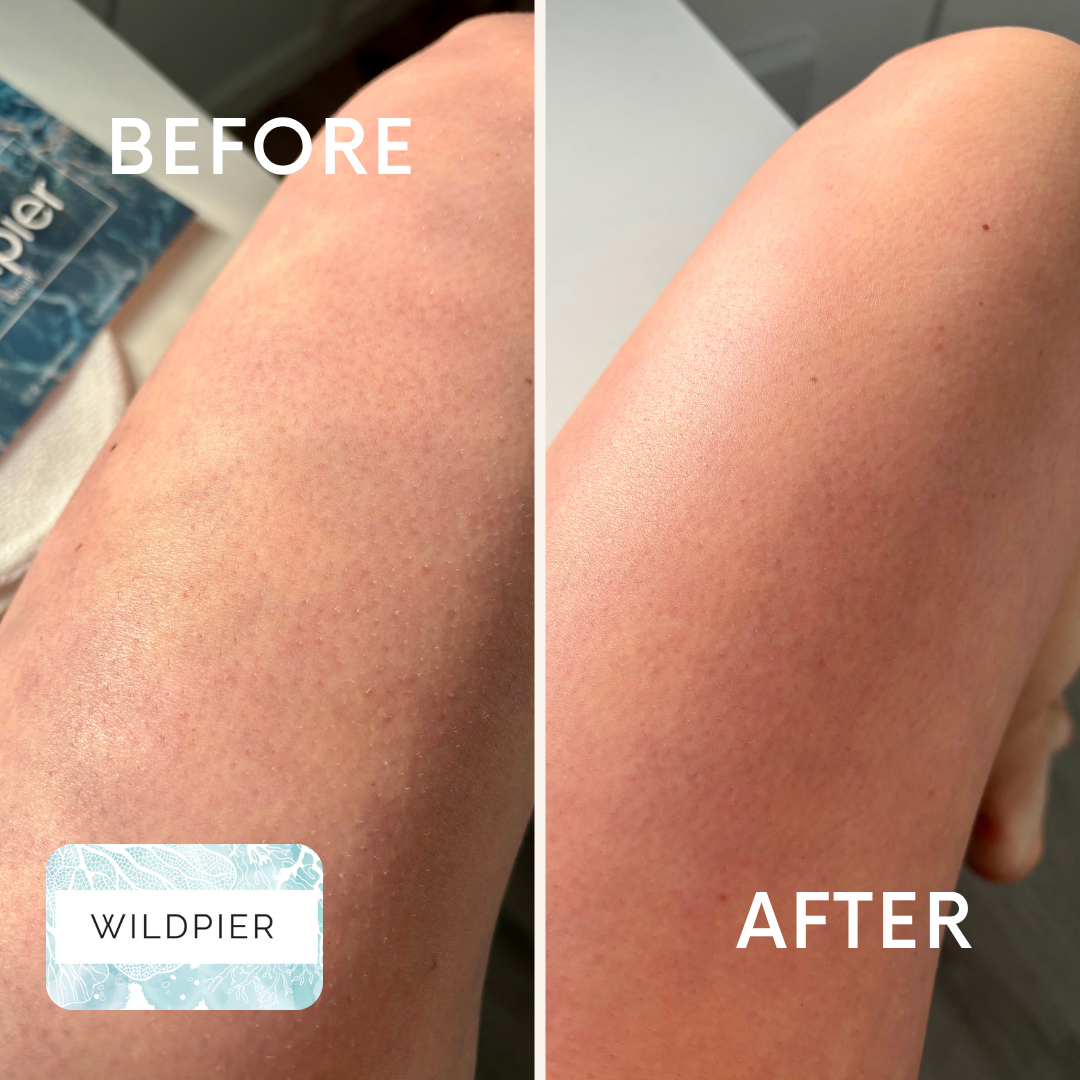 Wildpier™ Deep Exfoliating Glove and Konjac Sponge Bundle